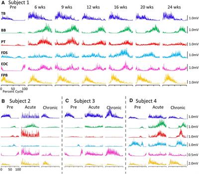 Emergence of functionally aberrant and subsequent reduction of neuromuscular connectivity and improved motor performance after cervical spinal cord injury in Rhesus